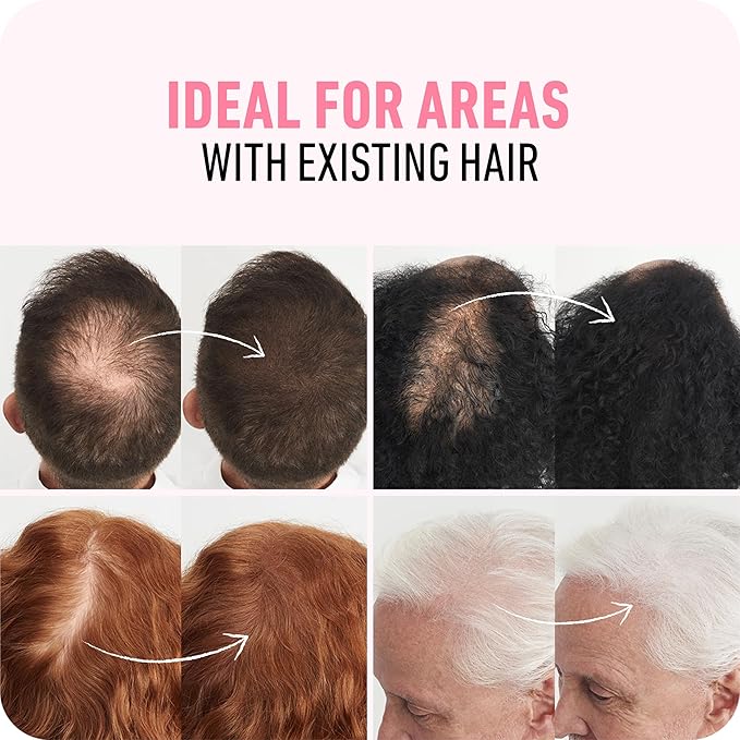 BOLDIFY Hair Fibers (2 x 56g) - Fill In Thinning and Fine Hair for an Instantly Fuller, Thicker Look - 14 Shades for Women & Men - Dark Brown