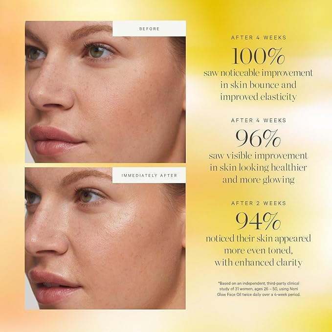 KORA Organics Noni Glow Hydrating Face Oil with Antioxidants, Nourish & Illuminate, Certified Organic, Cruelty Free, 0.34 fl oz