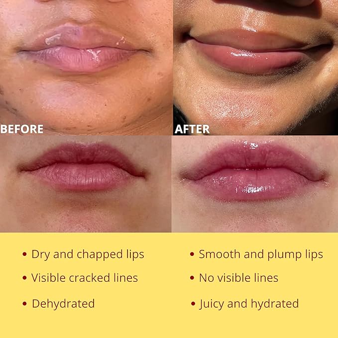 Original My Bee Balm Lip Balm - Propolis Hydrating Balm Honey Pot for Dry, Chapped & Cracked Lips with Propolis, Honey & Vitamin E - Soften, Smooth & Reduce Lip Lines (Pack of 2)