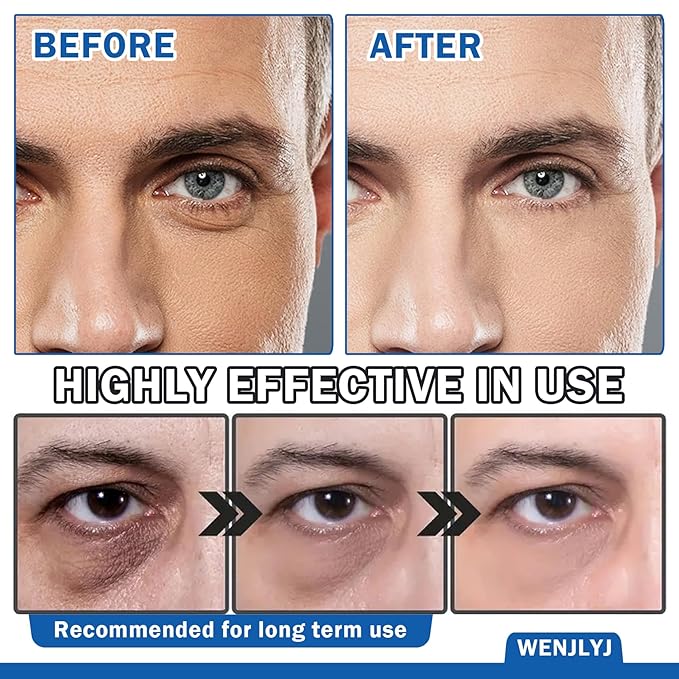 Men's Eye Cream,Hydrating Eye Cream for Men,Smooth Under Eye Cream for Dark Circles and Puffiness,Moisturizing Eye Cream Reduce Wrinkles Fine Lines & Firm Skin