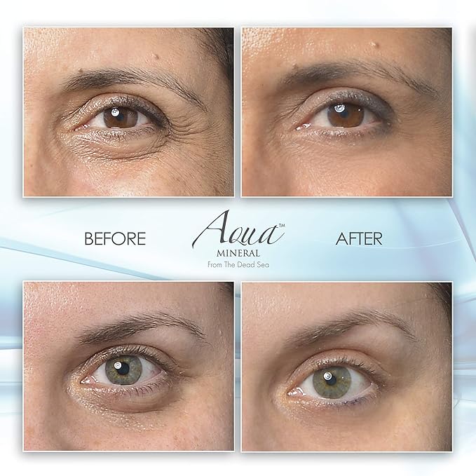 Puffy eye gel instant results