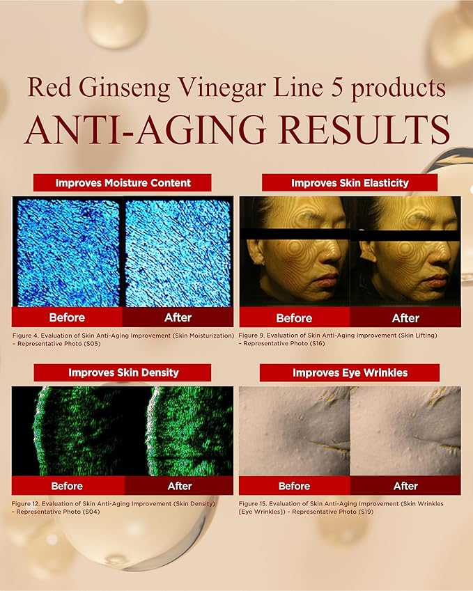 Bonyongo Red Ginseng Vinegar Skin Toner – Refreshing & Moisturizing Face Toner for Smooth, Youthful Skin - with Fermented Red Ginseng - Korean Skincare, 5.07 fl.oz.