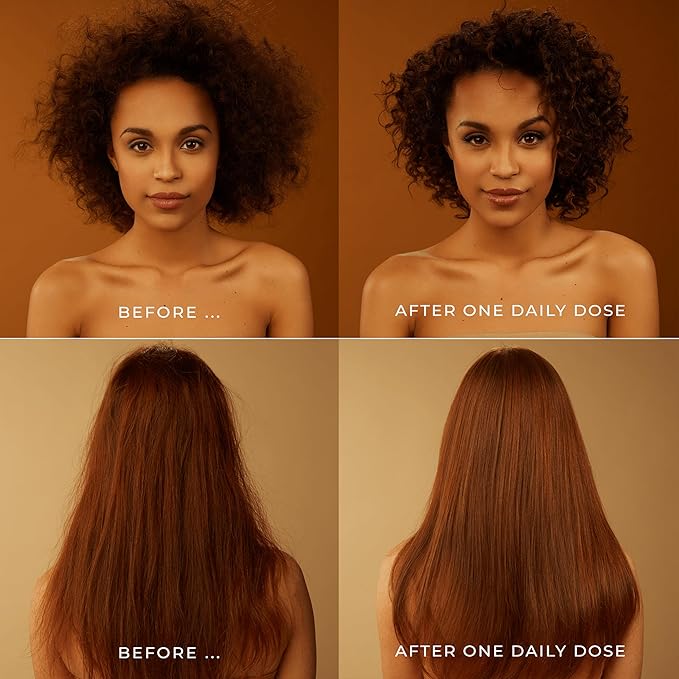 DAILY DOSE Effortless Detangler Spray & Leave In Conditioner for Dry, Damaged, & Frizzy Hair. Instantly Softens, Smooths & Adds Shine. For Kids & Adults. Award-winning, Vegan, Sulfate-Free, Color Safe