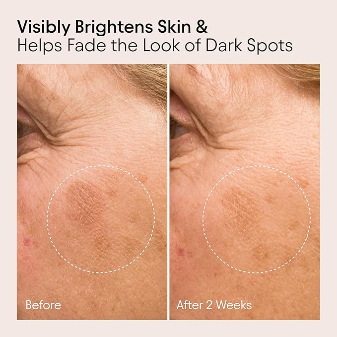 ALPYN Instant Brightening Glow Serum I Multitasking Serum I Visible Glow I Targets Fine Lines