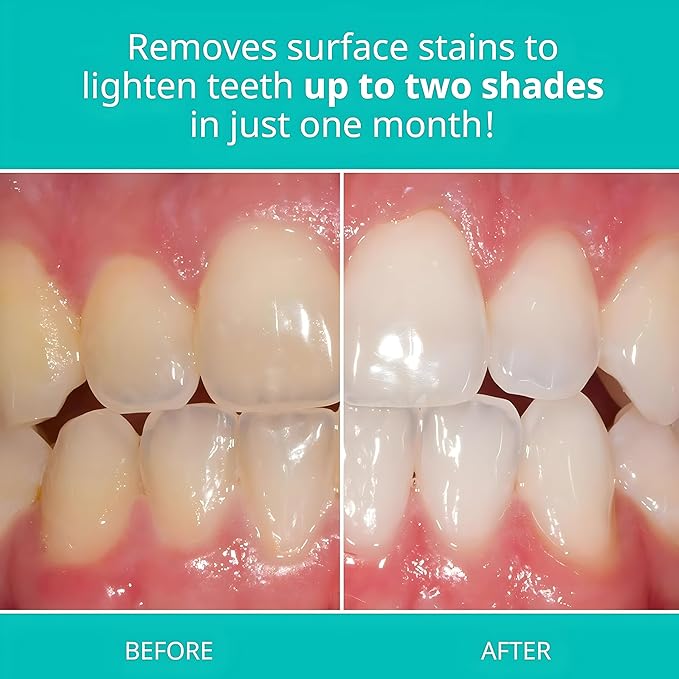 Opalescence Whitening Toothpaste for Sensitive Teeth (6 Pack) - Oral Care, Mint Flavor, Gluten Free - 5167-6