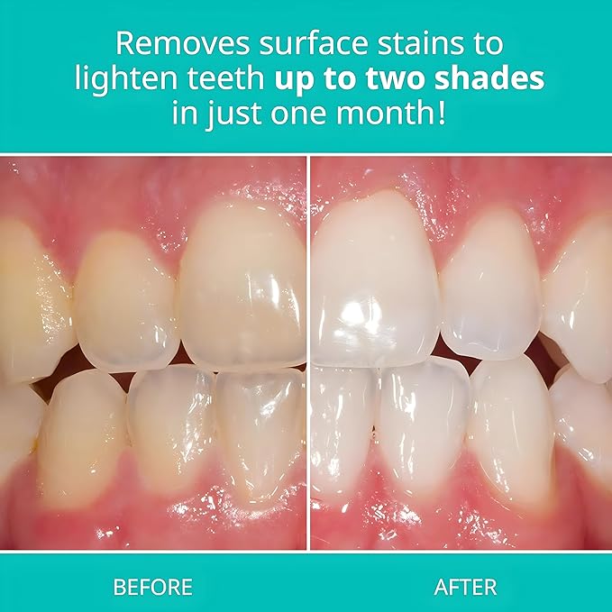 Opalescence Whitening Toothpaste for Sensitive Teeth (1 Pack) - Oral Care, Mint Flavor, Gluten Free - TP-5167-1