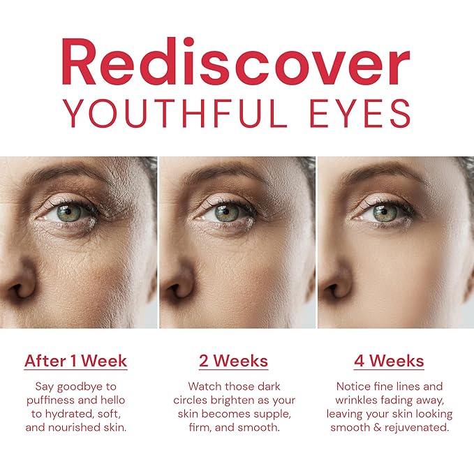 Retinol Eye Cream for Puffiness and Dark Circle: Anti-Aging Peptide Collagen Under Eye Treatment Reduce Wrinkles & Bags, Fine Lines & Depuffer in 4 Weeks Day & Night, 1.05 fl. oz