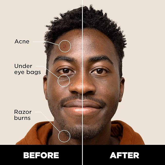 Stryx Concealer Stick Tool for Men, Dark Eclipse - Natural Pigments Hides Imperfections, Acne, Razor Burns, Scars, & Rosacea - Highly Adaptable Shades for Easy, Undetectable Coverage - All Skin Tones