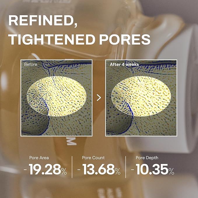 Whamisa Organic Cactus Magic Serum, Anti-Wrinkle & Brightening, Rejuvenation, Strengthen Skin Barrier, Probiotics, Hydrating, Facial Ampoule, Pore Refining (32ml)