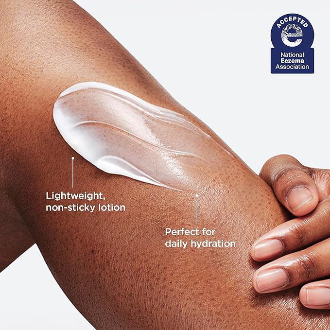 AESTURA ATOBARRIER365 Korean Body Lotion with Ceramides | Fast-Absorbing Moisturizer for Dry, Sensitive & Eczema-Prone Skin | Non-Comedogenic, Fragrance-Free, 400 mL / 13.5 fl oz