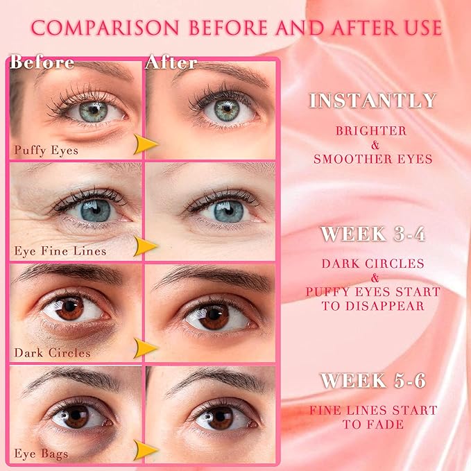 Pink Rose Eye Mask– 60 Pcs - Gold Under Eye Mask Retinol & Collagen - Puffy Eyes and Dark Circles Treatments – Look Younger and Reduce Wrinkles and Fine Lines Undereye, Improve and Firm eye