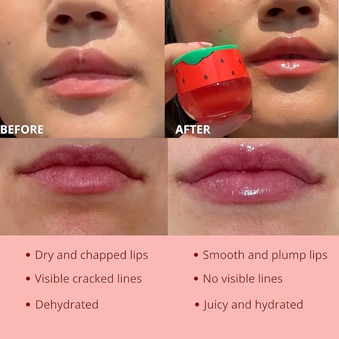 Original My Bee Balm Lip Balm - Watermelon Hydrating Balm Honey Pot for Dry, Chapped & Cracked Lips with Propolis, Honey & Vitamin E - Soften, Smooth & Reduce Lip Lines (Pack of 2)