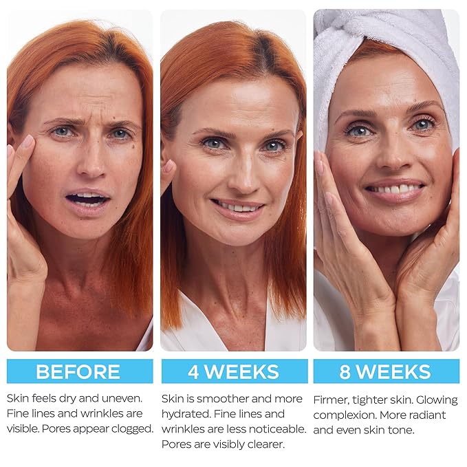 Retinol Cream for Face with Hyaluronic Acid, Day-Night Anti-Aging Moisturizer for Women, Men, Collagen Cream for Face Reduces Wrinkles, Dryness, 1.85 Oz