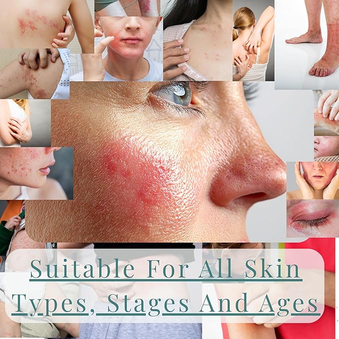 JusSpray™ Hypochlorous Acid (HOCl) Spray – Doctor Approved Skin Defense Mist 4 oz – Face & Body Toner for Sensitive, Acne & Eczema-Prone Skin, Redness Relief & Piercing Aftercare