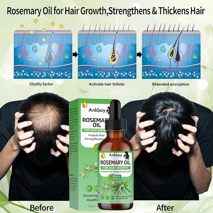 2 Pack Rosemary Oil for Hair Growth,Rosemary Hair Growth Oil,Hair Strengthening Serum for Dry Damaged Hair,Hair Loss Treatment & Thickens Hair,Scalp Care Promotes Hair Thickness for Men Women