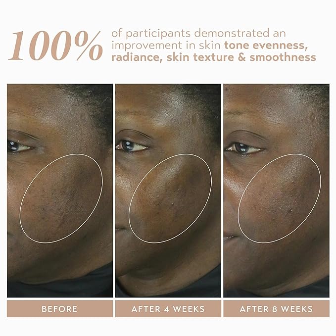 SHANI DARDEN SKIN CARE Retinol Reform with 1% Encapsulated Retinol Serum for Face & Neck, Gentle Slow-Release Face Serum with Tripeptide for Wrinkles, Fine Lines & Uneven Tone, 1 fl oz