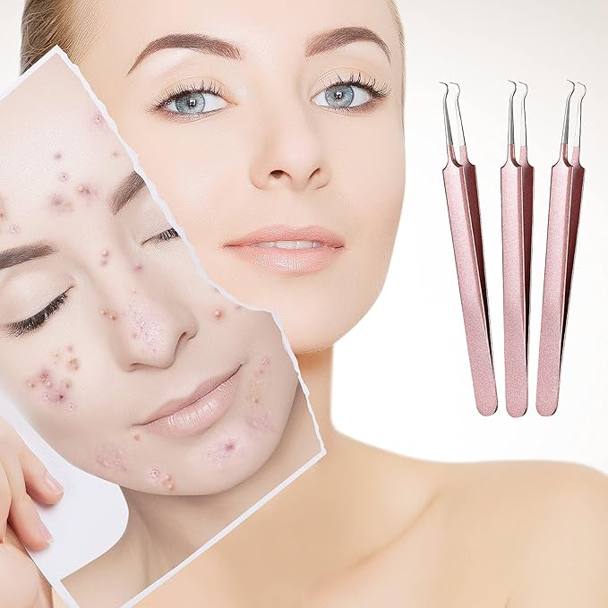 Honoson 3 Pcs Blackhead Tweezer Stainless Steel Pimple Tweezers Extractor Tool for Remove Zit Whitehead Pimple Bend Curved Tweezer Skin Blackhead Remover Tools(Champagne Purple)
