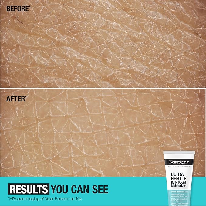 Neutrogena Fragrance Free Daily Facial Moisturizer, Face & Neck Moisturizer for Sensitive Skin with Vitamin B3, Pro-Vitamin B5 & Vitamin E Supports Skin's Dynamic Barrier, 3.4 fl. oz, Pack of 3