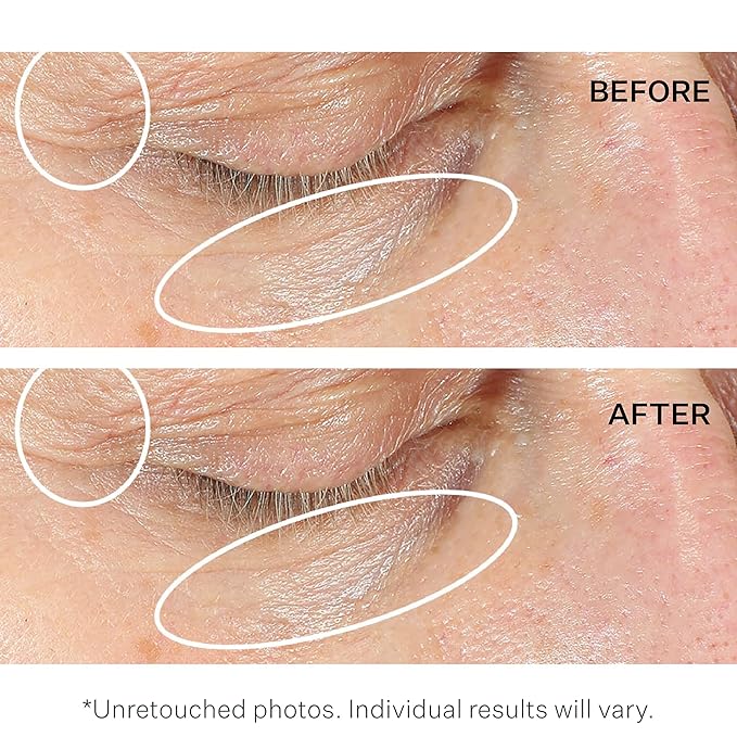 Strivectin anti-wrinkle intensive eye cream