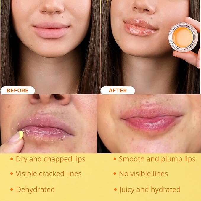 Original My Bee Balm Lip Balm - Peach Hydrating Balm Honey Pot for Dry, Chapped & Cracked Lips with Propolis, Honey & Vitamin E - Soften, Smooth & Reduce Lip Lines (Pack of 2)