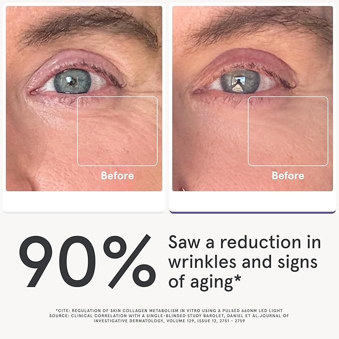 iRestore Red Light Therapy for Eyes – 180 LEDs Eye Mask with Infrared Light for Under-Eye Wrinkles, Forehead Lines, 11's, Crow’s Feet, Dark Circles