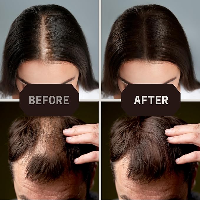 Striking Viking Hair Fibers for Thinning Hair, Dark Brown (28g) - Long Lasting, Undetectable Natural Building Powder for Thicker Looking Results, Men & Women
