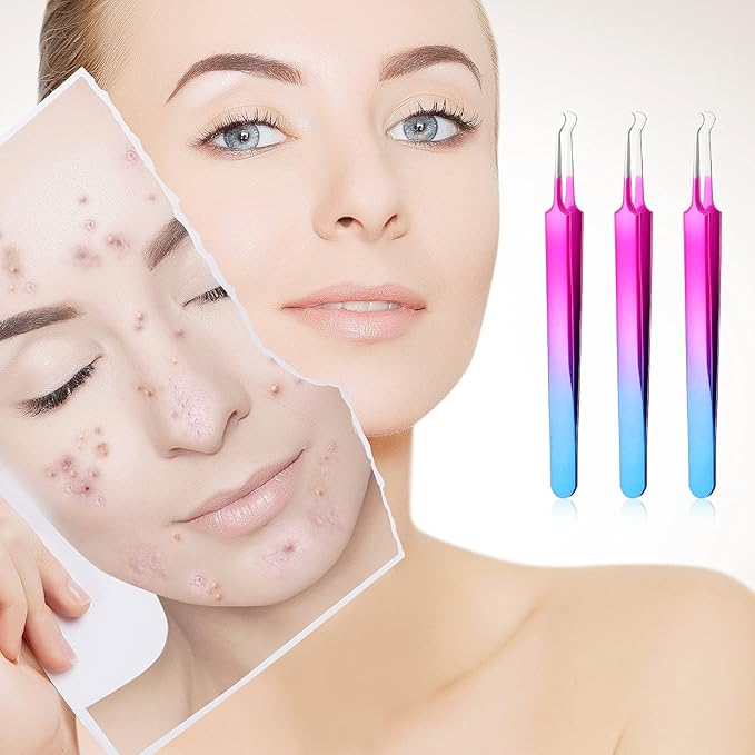 Honoson 3 Pcs Blackhead Tweezer Stainless Steel Pimple Tweezers Extractor Tool for Remove Zit Whitehead Pimple Bend Curved Tweezer Skin Blackhead Remover Tools(Rainbow Color)