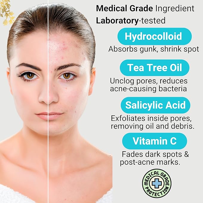 Miracle Patch - Invisible Pimple Patches for Face & Body,Fast-Acting Zit Stickers, Hydrocolloid Acne Treatment with Tea Tree Oil & Salicylic Acid–Waterproof, Hypoallergenic. 96 Counts 3 Sizes