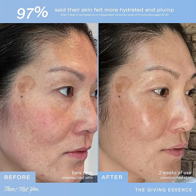 Then I Met You The Giving Essence, Vegan-Cruelty-Free Korean Skincare with 5% Niacinamide, Fermented Galactomyces, Red Algae & Berries for Brightening & Hydration, Suitable for All Skin Types, 5.07 oz