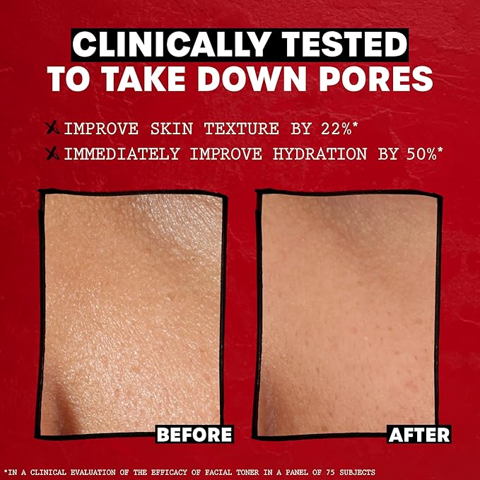 THAYERS Alcohol-Free Rose Petal Witch Hazel Facial Toner for Glowing Skin, Soothing, Hydrating, Refreshing Toner for All Skin Types, 12oz (Packaging May Vary)