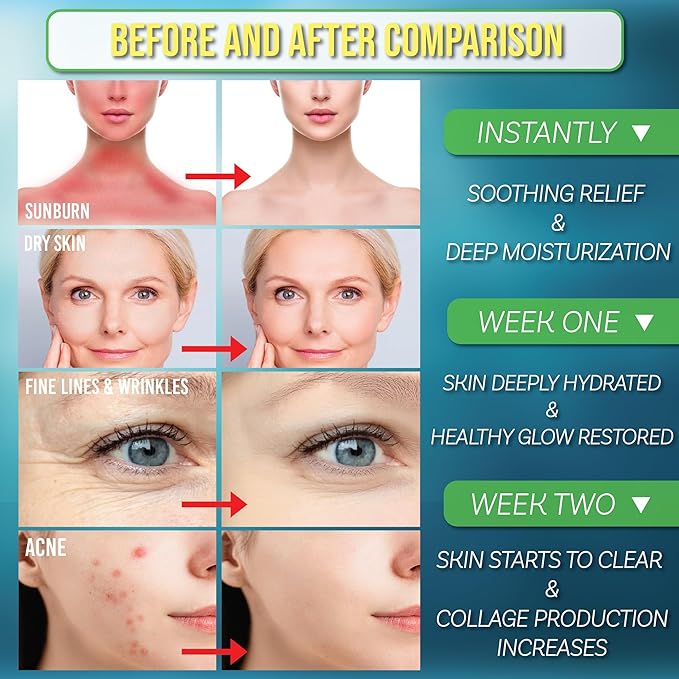 Royal SunFrog | All Natural SPF-50