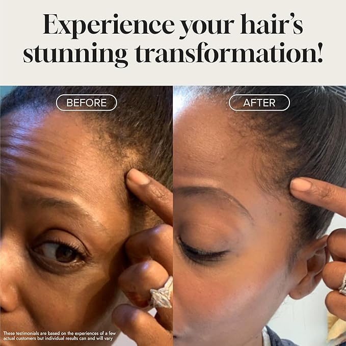 Biotin Hair Growth Serum Advanced Topical Formula To Help Grow Healthy, Strong Hair Suitable for Men and Women of All Hair Types Hair Loss Support By Pureauty Naturals 2 Fl Oz (Pack of 1)