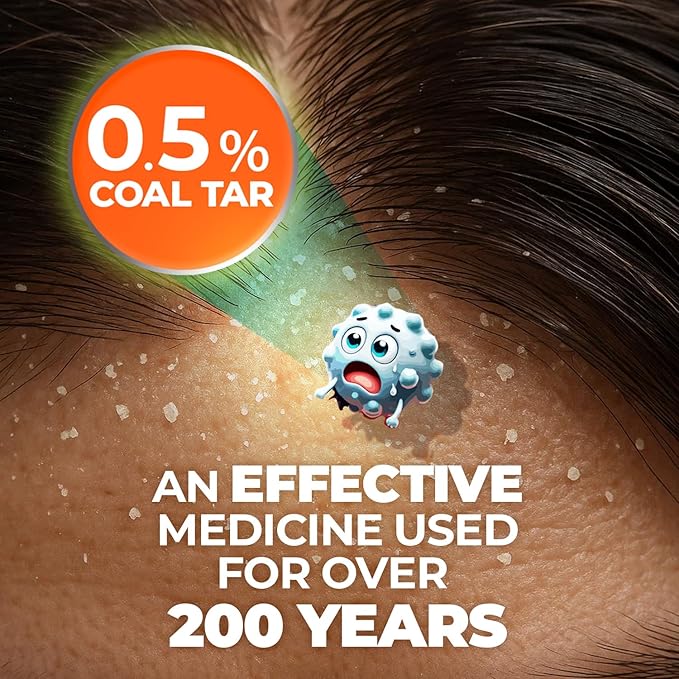 Medicasp Anti-Dandruff Shampoo and Massager Kit – Coal Tar for Dandruff, Psoriasis, and Seborrheic Dermatitis, Scalp Massager Brush for Exfoliation and Care, 6 fl oz