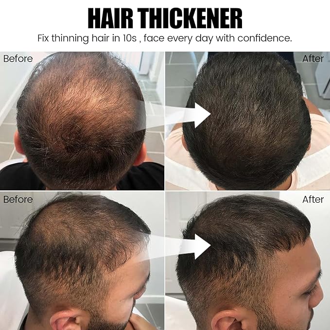 VOLLUCK Hair Thickening Fibers Spray, Temporary Colored Hair Thickener for Root Touch Up Spray, Grey Coverage Root Concealer for Women & Men, | Volumizing & Thickening | Dark Brown