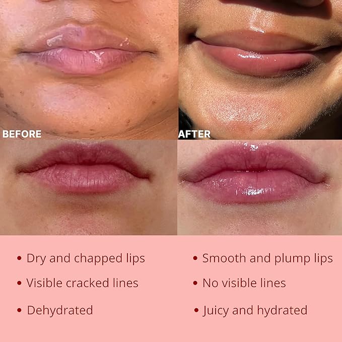 Original My Bee Balm Lip Balm - 2 pack Hydrating Balm Honey Pot for Dry, Chapped & Cracked Lips - Enriched with Propolis, Honey & Vitamin E - Soften, Smooth & Reduce Lip Lines