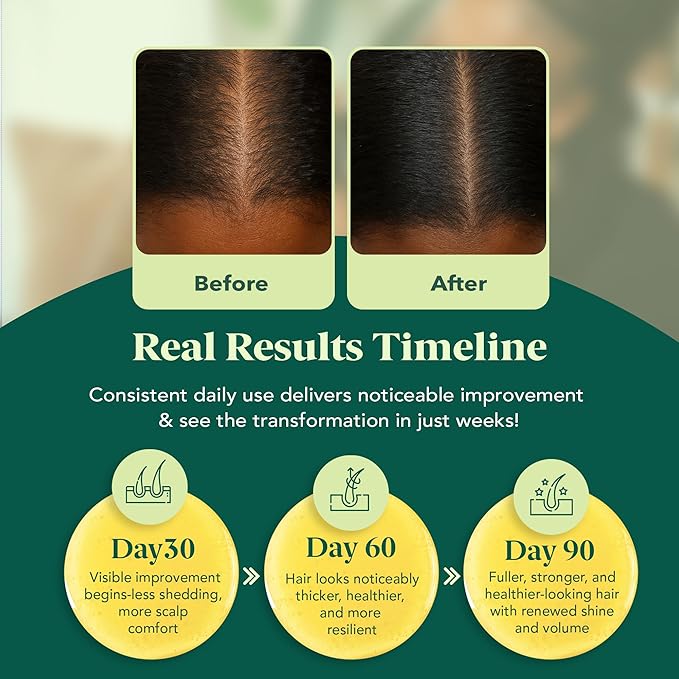 OCEAN VIEW DEEP WAVES POMADE Juice Boost- Hair Growth Oil & Scalp Serum – with Batana Oil, Rosemary & Castor – Argan, Vitamin E, Aloe Vera, Coconut – For Thinning Hair, 100ml