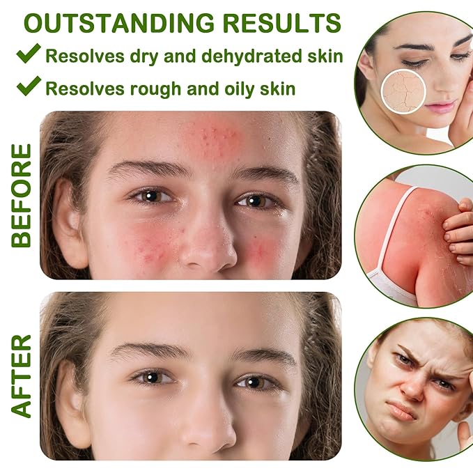 8PCS Travel Size Organic Aloe Vera Gel for Face & Body,Moisturizing Non-sticky Pure Aloe Gel After Sun Aloe Lotion Skin Care,Fast Absorbing Refreshing Hydrating Face Moisturizer for All Skin Types C