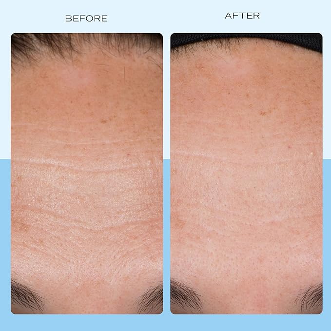 First Aid Beauty - Firming Collagen Cream with Peptides & Niacinamide, Ultra-Rich Plumping Moisturizer, Hydrates & Visibly Firms, Non-Comedogenic, Safe for Sensitive Skin, 3.5 oz