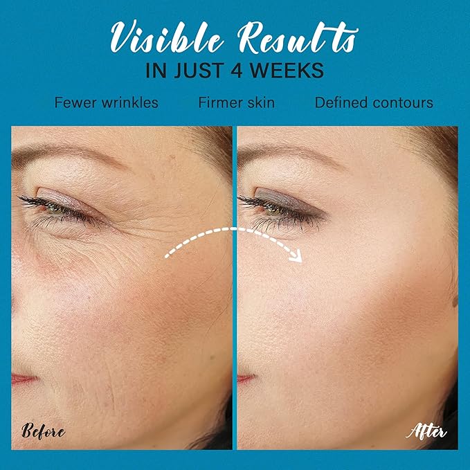 Skin Tighten And Lift Neck Cream: Face Lift Cream 6-in-1 Anti-Aging Moisturizer for Anti Wrinkle - Hydrating Neck Firming Cream with Retinol, Collagen, Peptide, Hyaluronic Acid for Neck & Décolleté