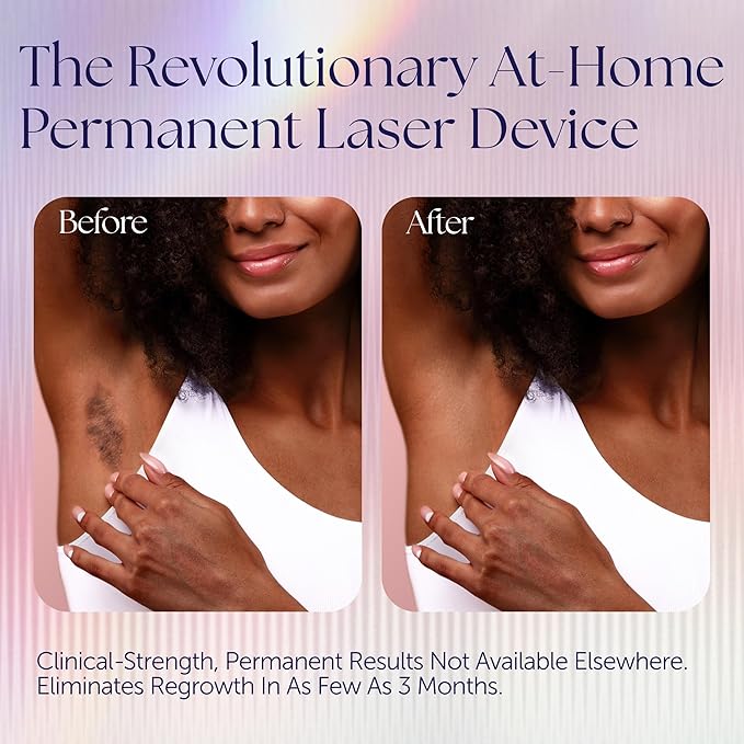 Epilaser At-Home Laser Hair Removal Device for Darker Skin, Safe, Intelligent, Clinical-Strength, Painless and Permanent Hair Removal for Face, Body, Bikini Line (Dark Skin)