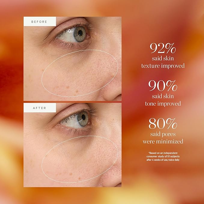 KORA Organics Turmeric Glow Drops, Certified Organic Radiance Face Serum with Niacinamide Alternative, Improves Texture & Pore Appearance, Vegan, 1.01 fl oz