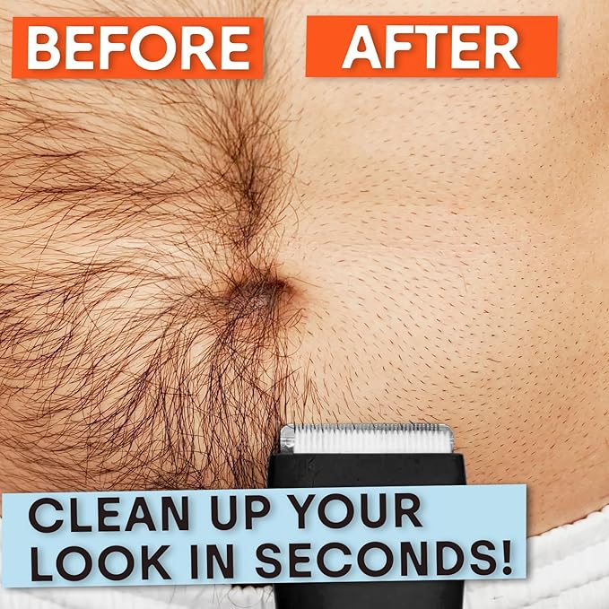 MERIDIAN The Trimmer Original - Body Hair Trimmer for Men, Electric Shaver for Pubic Hair, Chest, Legs & Bikini, Waterproof & Rechargeable, Onyx