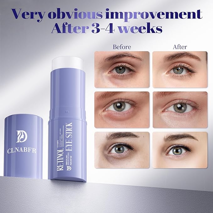 Retinol & Caffeine Eye Balm Stick for Dark Circles, Puffiness, Fine Lines and Eye Bags, Anti Aging Under Eye Cream Smooths Wrinkles Moisture Stick (0.24oz/7g)