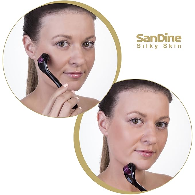 Microneedle Derma Roller - 540 Micro Needle Skin Care System - Ideal to Keep Your Skin Young and Radiant - Titanium for Silky Smooth and Beautiful Skin - Includes FREE E-Book -By Sandine (0.3mm)