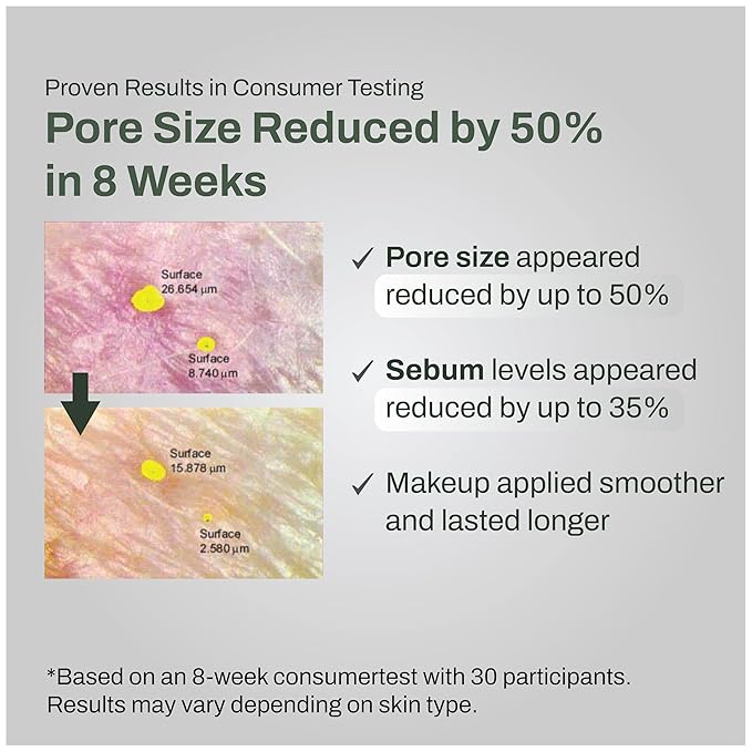 Pore Control Cleansing Gel Foam - Korean Skincare Gel to Foam Cleanser with Green Tea, Chestnut Shell, and Botanical Complex for Pore Care, Sebum Balance and Makeup Removal, 155ml / 5.24 fl.oz.