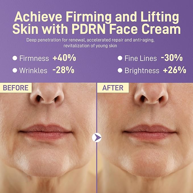 PDRN Anti-Aging Face Moisturizers Cream with 5% Squalane,100% Pure PDRN Salmon DNA,Hyaluronic Acid & B5, Firming, Hydrating, Moisturizing Repair Face & Neck Skinare Cream for All Skin,1.85 Fl Oz