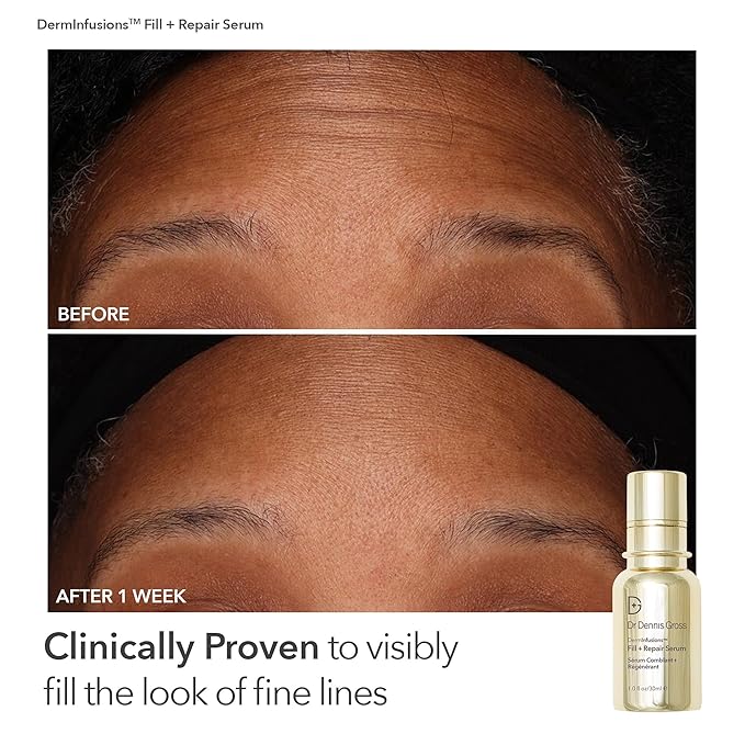 Dr. Dennis Gross Fill, Plump & Firm Kit – DermInfusions™ Hyaluronic Acid Serum, Eye Cream & Lip Treatment | Boost Hydration, Smooth Fine Lines & Enhance Volume | $125 Value Limited Edition Gift Set