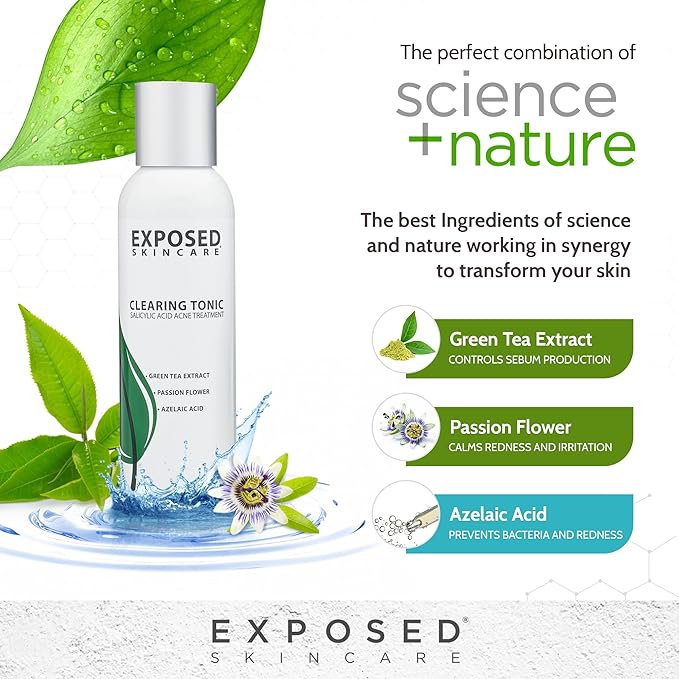 Exposed Skin Care, Clearing Tonic Facial Toner with 1% Salicylic Acid and Witch Hazel – Daily Toner for Teen and Adult Acne, Blackheads and Oily Skin – Natural, Non-Toxic and Cruelty Free