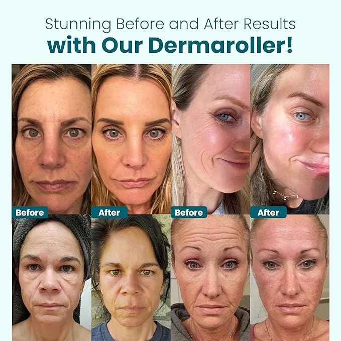 Gin Amber Beauty Derma Roller with Replaceable Head Design – 192 Real individual needles, Micro Needling Roller for Face, Beard, and Scalp Care, 0.25mm Face Roller