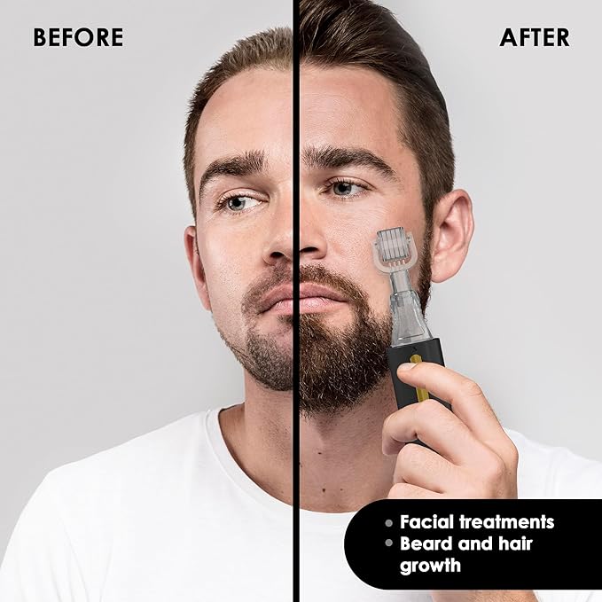 Derma roller with Reservoir for Hair, Beard, Skin, Lips, Wrinkles, Stretch Marks, Hyperpigmentation INSTANT SERUM APPLICATION, 105 Titanium Needles 0.25 mm